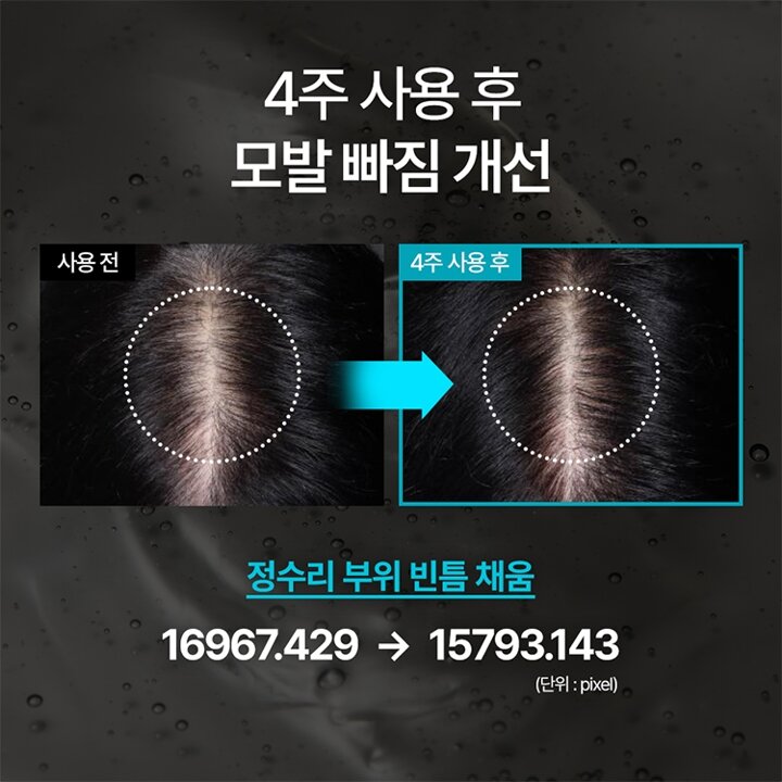 [1+1] 블랙빈 탈모증상개선 집중 앰플