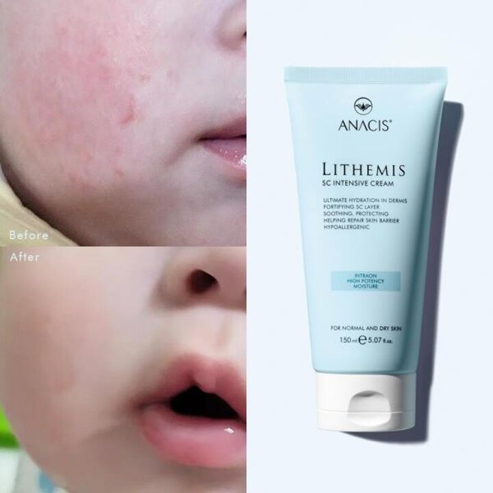 아트박스/아나시스 리더미스 악건성 병풀 재생 수분 크림 150ml