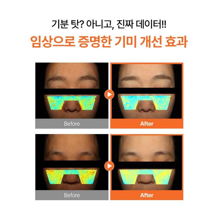 [1+1] 맥퀸뉴욕 다크스팟제로 트라넥삼산 기미크림 대용량 100g/ 잡티 미백 PDRN/ 기미 색소침착 114.53 개선 임상