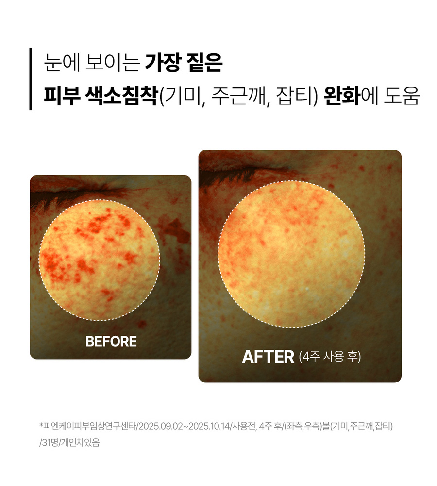 [NH카드5%할인][90매] NEW 동국제약 마데카 더마 마스크팩 인텐시브 리프팅 포뮬러